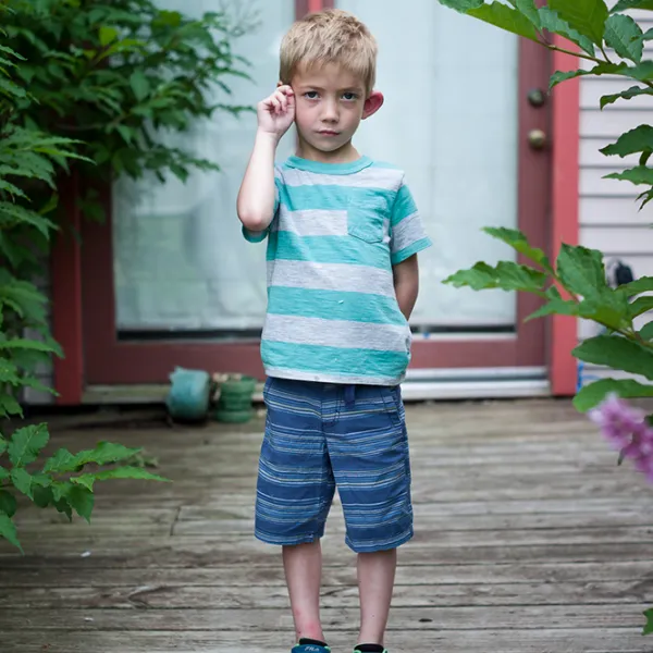 Arlo's Bug Bite 2015, inkjet print, 21 x 14"